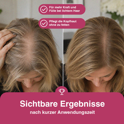 Fetoxin Haarserum für Frauen 50 ML